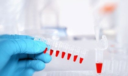 生物標(biāo)志物平臺