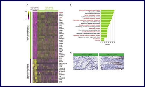 GUT 高分文章‖基因組測序 + 單細胞測序應(yīng)用于發(fā)病機制研究