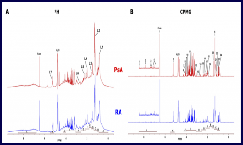 代謝組 | 利用代謝物和脂質(zhì)類差異來鑒定 negRA 和 PsA 潛在生物標志物
