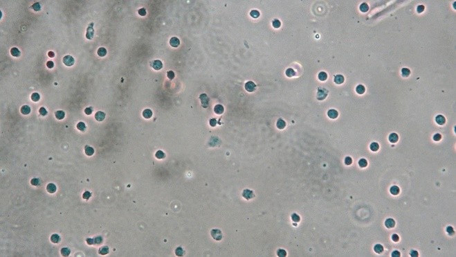小鼠腦組織細胞核分離
