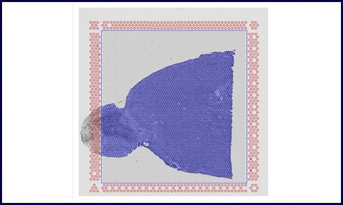 空間轉(zhuǎn)錄組 | 專業(yè)的 10x 空間轉(zhuǎn)錄組 summary 網(wǎng)頁報告解讀