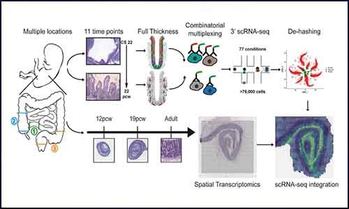 強強聯(lián)手 | 單細胞測序 & 空間轉(zhuǎn)錄組測序揭示腸道發(fā)育
