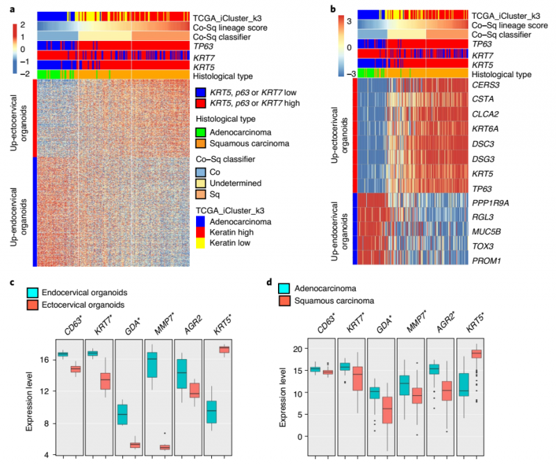 宮頸癌 SCC 和 ADC 的轉(zhuǎn)錄特征與鱗狀和柱狀上皮譜系相關(guān)