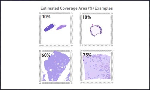 空間轉(zhuǎn)錄組測序 | 實(shí)驗(yàn)踩坑心得