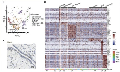 單細(xì)胞測序加速藥物研發(fā) | 藥物靶點(diǎn)發(fā)現(xiàn)及驗(yàn)證！