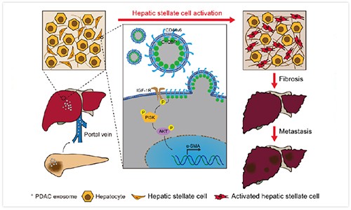 科研文獻(xiàn) | 外泌體在腫瘤領(lǐng)域研究