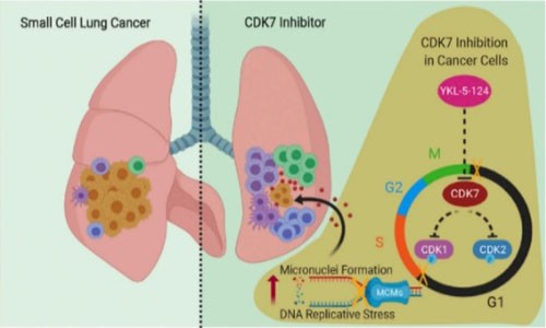 抑制 CDK7 表達(dá)破壞基因組復(fù)制進(jìn)程，觸發(fā)抗腫瘤免疫反應(yīng)
