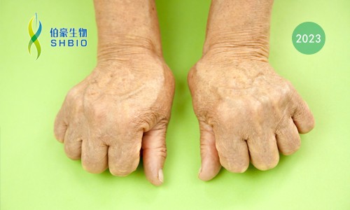 高分文獻(xiàn)一作分享會(huì) | 時(shí)空組學(xué)技術(shù)助力發(fā)現(xiàn)類風(fēng)濕關(guān)節(jié)炎疾病治療新靶點(diǎn)