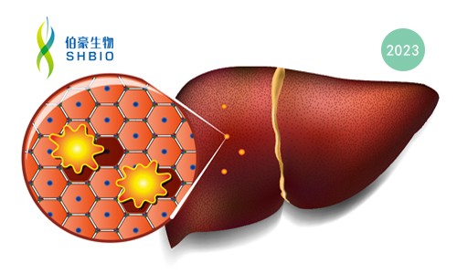 高分文獻(xiàn)一作分享會(huì) | 肝細(xì)胞癌早期檢測(cè)生物標(biāo)志物研究分享