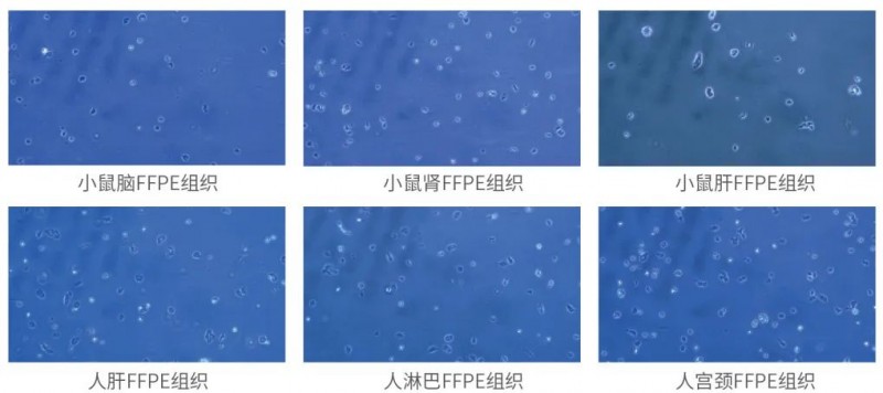 細(xì)胞核鏡檢