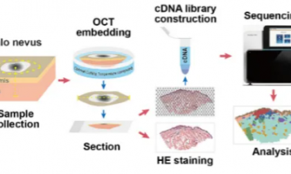 項目文章 | 暈痣黑色素細胞代謝異常與樹突狀細胞活化有關(guān)