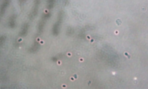 小鼠肺組織樣本使用試劑效果圖