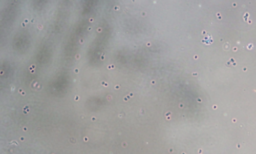 密度梯度離心法伯優(yōu)細(xì)胞核分離試劑盒使用效果圖